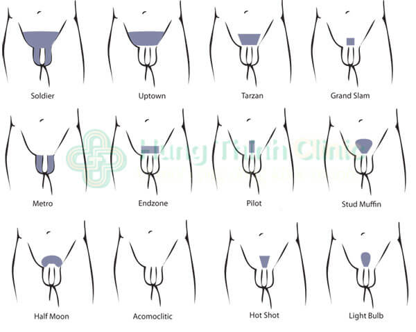 Cách Tỉa Lông Vùng Kín Cho Nam