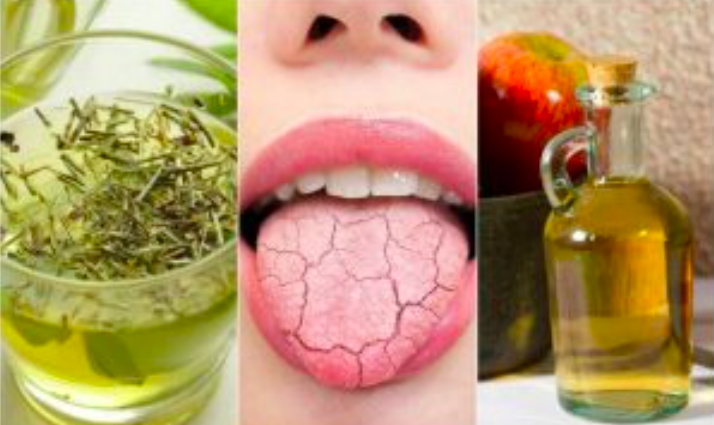 5 Biện Pháp Tự Nhiên Hiệu Quả Để Giảm Khô Miệng 5 Biện Pháp Tự Nhiên Hiệu Quả Để Giảm Khô Miệng