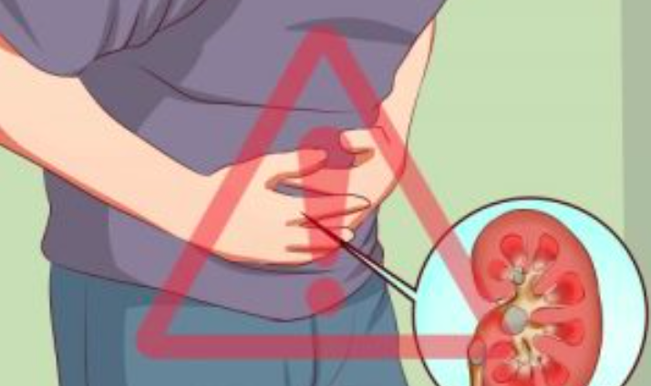 6 Đồ Uống Giảm Đau Thận 6 Đồ Uống Giảm Đau Thận