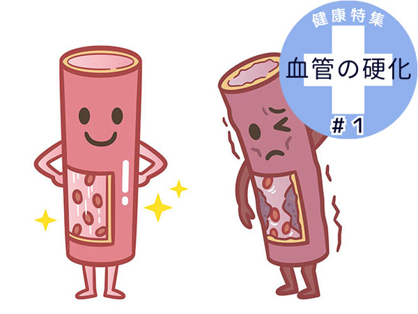 Giữ Cho Mạch Máu Của Bạn Luôn Linh Hoạt Và Khỏe Mạnh! 7 Thói Quen Cần Thiết Là Gì? Giữ Cho Mạch Máu Của Bạn Luôn Linh Hoạt Và Khỏe Mạnh! 7 Thói Quen Cần Thiết Là Gì?