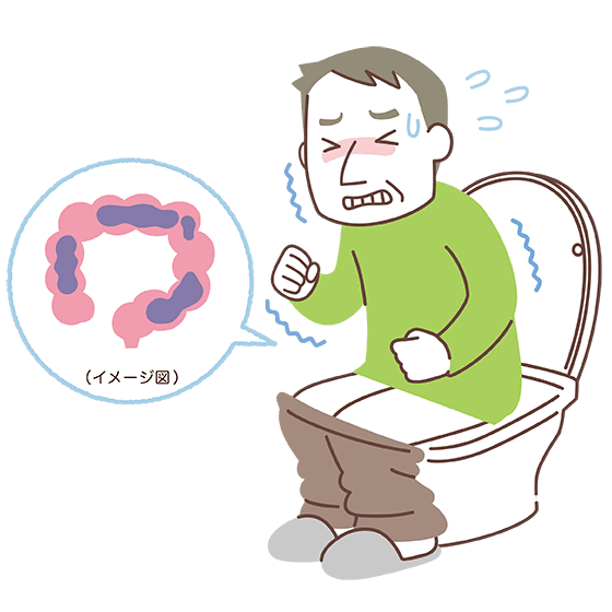 Bí mật của Ruột: Chìa khóa cho Làn Da Đẹp, Hệ Miễn Dịch Mạnh Mẽ, Chế Độ Ăn Uống Lành Mạnh và Sức Khỏe Tinh Thần Bí mật của Ruột: Chìa khóa cho Làn Da Đẹp, Hệ Miễn Dịch Mạnh Mẽ, Chế Độ Ăn Uống Lành Mạnh và Sức Khỏe Tinh Thần