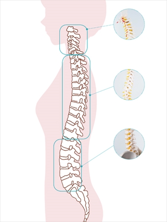 Biến Dạng Cột Sống Có Thể Tác Động Đến Hệ Thần Kinh Tự Chủ. Hãy Chú Ý Đến Cách Bạn Di Chuyển. Biến Dạng Cột Sống Có Thể Tác Động Đến Hệ Thần Kinh Tự Chủ. Hãy Chú Ý Đến Cách Bạn Di Chuyển.