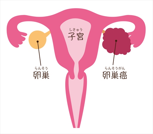 Giới Thiệu Về Các Loại Ung Thư Thường Gặp Ở Phụ Nữ Trên 50 Tuổi Giới Thiệu Về Các Loại Ung Thư Thường Gặp Ở Phụ Nữ Trên 50 Tuổi