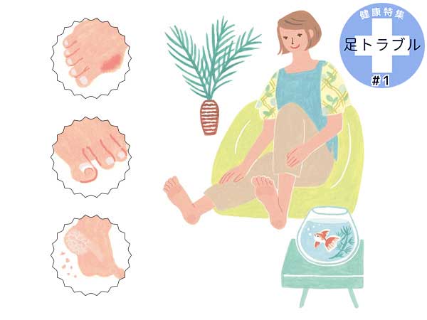 Nguyên Nhân Gây Ra Các Vấn Đề Về Chân Ở Phụ Nữ Là Gì? Nguyên Nhân Gây Ra Các Vấn Đề Về Chân Ở Phụ Nữ Là Gì?