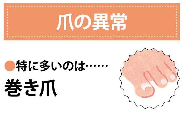 Nguyên Nhân Gây Ra Các Vấn Đề Về Chân Ở Phụ Nữ Là Gì? Nguyên Nhân Gây Ra Các Vấn Đề Về Chân Ở Phụ Nữ Là Gì?
