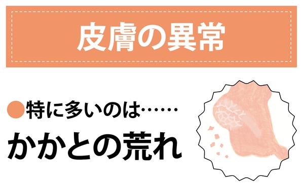 Nguyên Nhân Gây Ra Các Vấn Đề Về Chân Ở Phụ Nữ Là Gì? Nguyên Nhân Gây Ra Các Vấn Đề Về Chân Ở Phụ Nữ Là Gì?