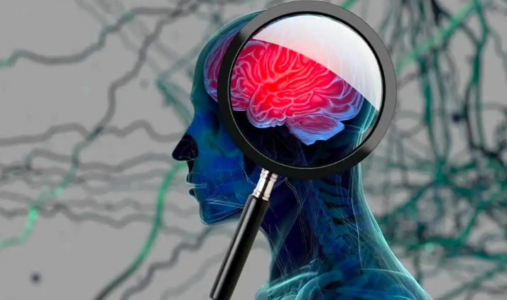 Cách Nhận Biết Dấu Hiệu Bệnh Alzheimer Cách Nhận Biết Dấu Hiệu Bệnh Alzheimer