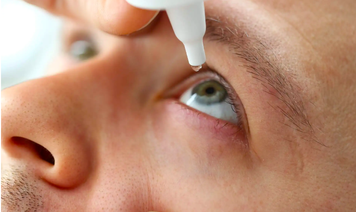 600 Cách Sử Dụng Thuốc Nhỏ Mắt Để Điều Trị Khô Mắt