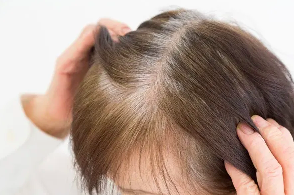 Cải Thiện Sức Khỏe Da Đầu Và Nuôi Dưỡng Tóc Chắc Khỏe Cải Thiện Sức Khỏe Da Đầu Và Nuôi Dưỡng Tóc Chắc Khỏe