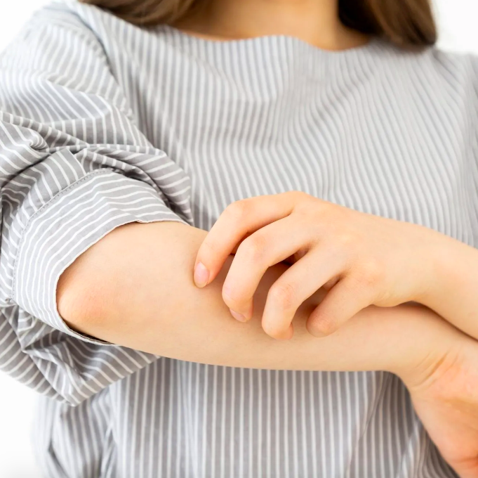 Chàm Nội Tạng Là Gì? Triệu Chứng, Nguyên Nhân & Phương Pháp Điều Trị Chàm Nội Tạng Là Gì? Triệu Chứng, Nguyên Nhân & Phương Pháp Điều Trị