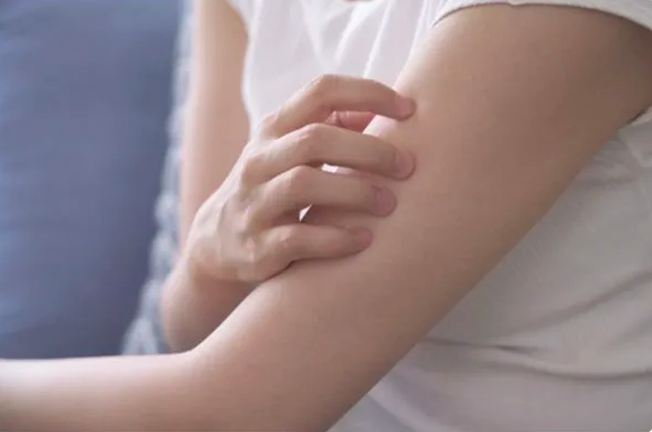 Chàm Nội Tạng Là Gì? Triệu Chứng, Nguyên Nhân & Phương Pháp Điều Trị Chàm Nội Tạng Là Gì? Triệu Chứng, Nguyên Nhân & Phương Pháp Điều Trị