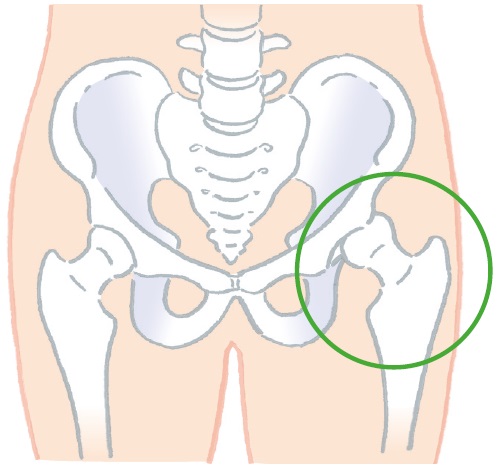 Kiểm Tra Khớp Hông Yếu! Chăm Sóc Đau Đầu Gối, Hông Và Vùng Xương Chậu Kiểm Tra Khớp Hông Yếu! Chăm Sóc Đau Đầu Gối, Hông Và Vùng Xương Chậu
