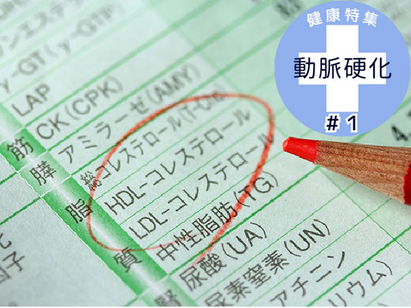 Chỉ Số Cholesterol Tiêu Chuẩn Thay Đổi Sau Tuổi 55 Chỉ Số Cholesterol Tiêu Chuẩn Thay Đổi Sau Tuổi 55