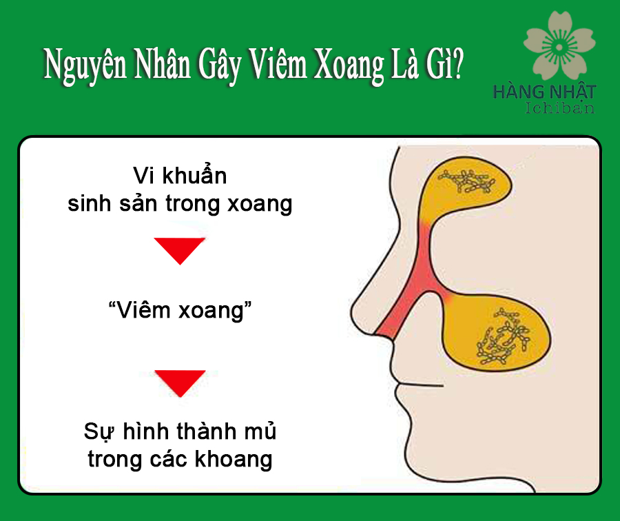 Thuốc Xịt Viêm Mũi Chikunain - Giải Pháp Hiệu Quả Cho Nghẹt Mũi Thuốc Xịt Viêm Mũi Chikunain - Giải Pháp Hiệu Quả Cho Nghẹt Mũi