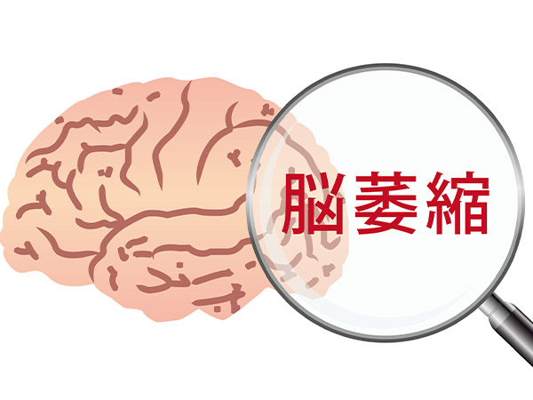 Để Tránh Tình Trạng "Bộ Não Của Ông Già"! 4 Điều Cần Thực Hiện Để Tránh Tình Trạng "Bộ Não Của Ông Già"! 4 Điều Cần Thực Hiện