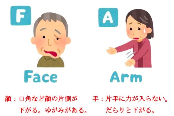 Đừng Xem Nhẹ Dấu Hiệu Đột Quỵ Bất Ngờ! Hãy Kiểm Tra NHANH Trong 3 Giây Đừng Xem Nhẹ Dấu Hiệu Đột Quỵ Bất Ngờ! Hãy Kiểm Tra NHANH Trong 3 Giây