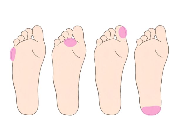 Tự Kiểm Tra, Phòng Ngừa Và Giãn Cơ Viêm Cân Gan Chân! Tự Kiểm Tra, Phòng Ngừa Và Giãn Cơ Viêm Cân Gan Chân!