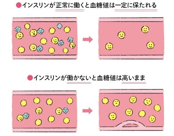 Phụ Nữ Cần Chú Ý! Hãy Phòng Ngừa Tăng Đường Huyết Bảo Vệ Não Bộ Và Cơ Thể Khỏi Các Bệnh Tật. Phụ Nữ Cần Chú Ý! Hãy Phòng Ngừa Tăng Đường Huyết Bảo Vệ Não Bộ Và Cơ Thể Khỏi Các Bệnh Tật.