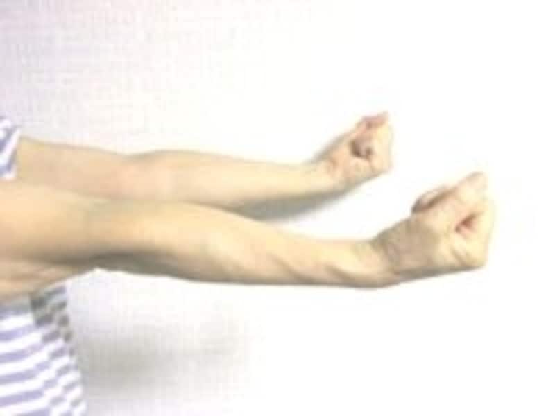 Hãy Cẩn Thận Nếu Bạn Bị Cứng Vai Nghiêm Trọng! “Hội Chứng Cổ-Vai-Cánh Tay'' Gây Tê Cánh Tay, Ngón Tay Là Gì? Hãy Cẩn Thận Nếu Bạn Bị Cứng Vai Nghiêm Trọng! “Hội Chứng Cổ-Vai-Cánh Tay'' Gây Tê Cánh Tay, Ngón Tay Là Gì?