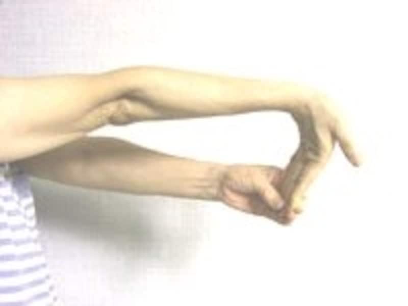 Hãy Cẩn Thận Nếu Bạn Bị Cứng Vai Nghiêm Trọng! “Hội Chứng Cổ-Vai-Cánh Tay'' Gây Tê Cánh Tay, Ngón Tay Là Gì? Hãy Cẩn Thận Nếu Bạn Bị Cứng Vai Nghiêm Trọng! “Hội Chứng Cổ-Vai-Cánh Tay'' Gây Tê Cánh Tay, Ngón Tay Là Gì?