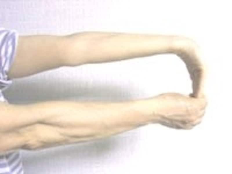 Hãy Cẩn Thận Nếu Bạn Bị Cứng Vai Nghiêm Trọng! “Hội Chứng Cổ-Vai-Cánh Tay'' Gây Tê Cánh Tay, Ngón Tay Là Gì? Hãy Cẩn Thận Nếu Bạn Bị Cứng Vai Nghiêm Trọng! “Hội Chứng Cổ-Vai-Cánh Tay'' Gây Tê Cánh Tay, Ngón Tay Là Gì?