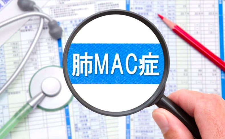 Ho Kéo Dài Có Thể Do "Hội Chứng Nhầy Phổi", Thường Gặp Ở Phụ Nữ Trên 50 Tuổi! Ho Kéo Dài Có Thể Do "Hội Chứng Nhầy Phổi", Thường Gặp Ở Phụ Nữ Trên 50 Tuổi!