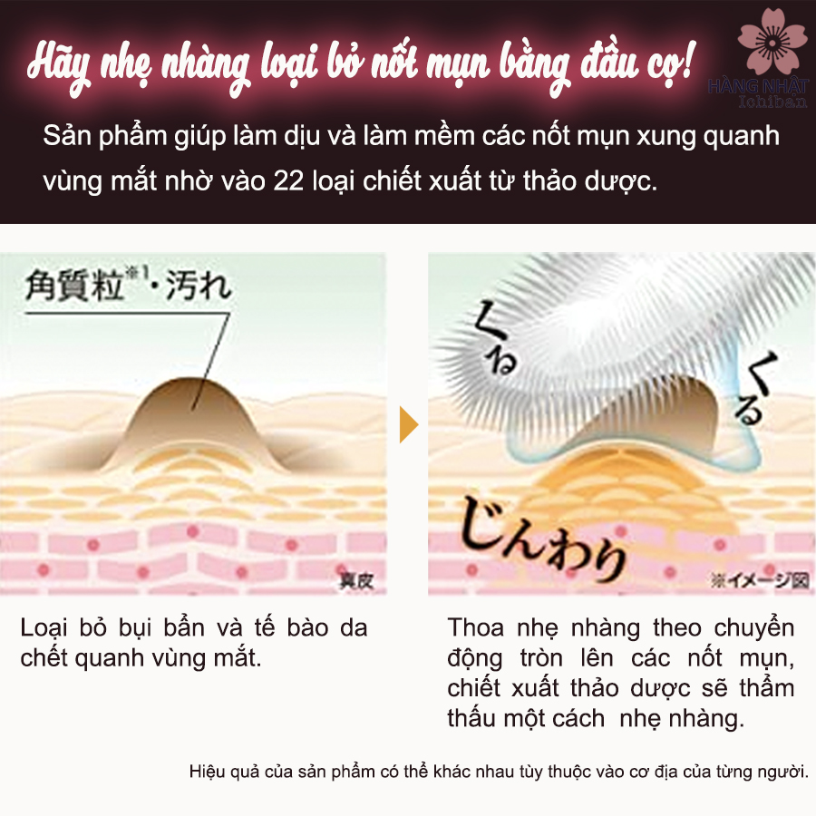 Gel Thảo Dược Trị Mụn Thịt Vùng Mắt Tsubuporon Gel Thảo Dược Trị Mụn Thịt Vùng Mắt Tsubuporon