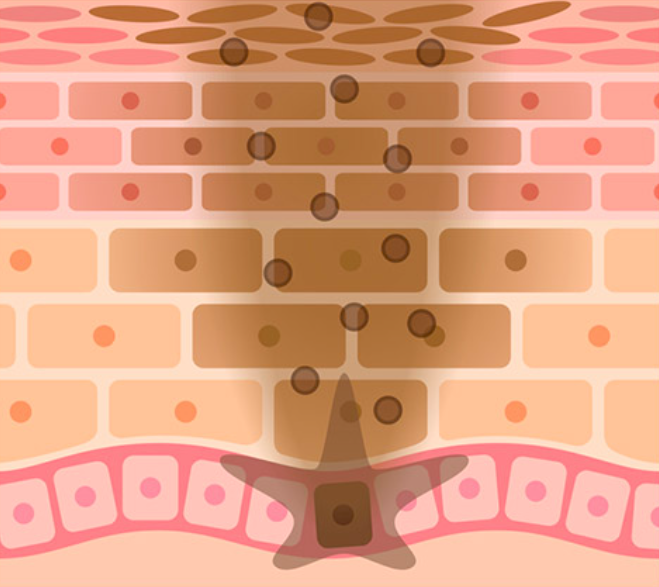 Không Có Sản Phẩm Làm Trắng Nào Có Thể Xóa Tan Hoàn Toàn Vết Cháy Nắng Hoặc Đốm Đồi Trên Da. Không Có Sản Phẩm Làm Trắng Nào Có Thể Xóa Tan Hoàn Toàn Vết Cháy Nắng Hoặc Đốm Đồi Trên Da.