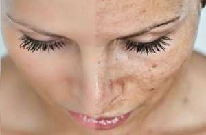 5 Nguyên Nhân Gây Lão Hóa Sớm 5 Nguyên Nhân Gây Lão Hóa Sớm