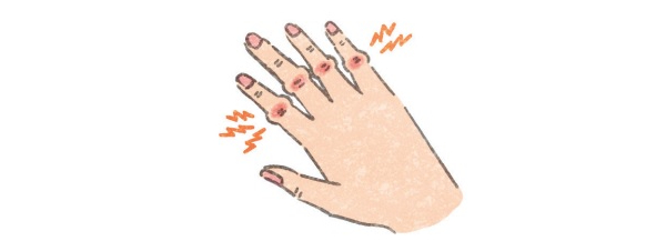 Một Căn Bệnh Tiềm Ẩn! Tê Và Đau Ngón Tay Là Gì? Một Căn Bệnh Tiềm Ẩn! Tê Và Đau Ngón Tay Là Gì?