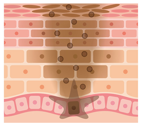 Mỹ Phẩm Làm Trắng Không Có Khả Năng Điều Trị Vết Cháy Nắng Và Đốm Nâu Mỹ Phẩm Làm Trắng Không Có Khả Năng Điều Trị Vết Cháy Nắng Và Đốm Nâu