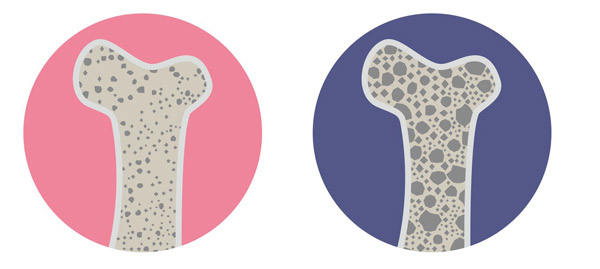 Ngăn Ngừa Lão Hóa Ở Cấp Độ Tế Bào! Căng Thẳng Oxy Hóa Là Nguyên Nhân Khiến Bạn Trông Già Đi Ngăn Ngừa Lão Hóa Ở Cấp Độ Tế Bào! Căng Thẳng Oxy Hóa Là Nguyên Nhân Khiến Bạn Trông Già Đi