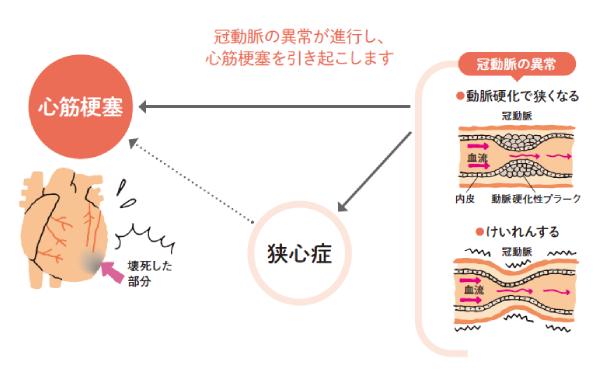 Nguy Cơ Đột Tử! Những Bệnh Tim Cần Lưu Ý Từ Tuổi 50 Trở Lên Nguy Cơ Đột Tử! Những Bệnh Tim Cần Lưu Ý Từ Tuổi 50 Trở Lên