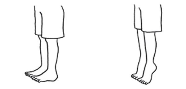 Nguyên Nhân Gây Sưng Chân Là Gì? Một Dấu Hiệu Của Bệnh Tật? Biện Pháp Khắc Phục Và Cách Phòng Ngừa Nguyên Nhân Gây Sưng Chân Là Gì? Một Dấu Hiệu Của Bệnh Tật? Biện Pháp Khắc Phục Và Cách Phòng Ngừa