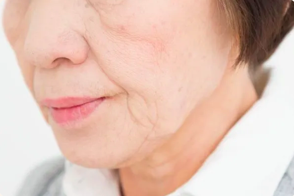 Nguyên Nhân Và Cách Ngăn Ngừa Nếp Nhăn, Vết Chân Chim Hiệu Quả! Nguyên Nhân Và Cách Ngăn Ngừa Nếp Nhăn, Vết Chân Chim Hiệu Quả!