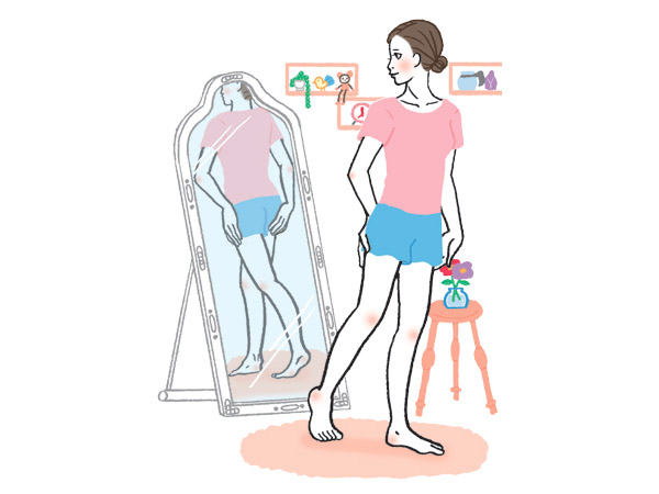 Những Dấu Hiệu Của Bệnh Giãn Tĩnh Mạch Là Gì? Tự Kiểm Tra Và Chẩn Đoán Qua Hình Ảnh. Những Dấu Hiệu Của Bệnh Giãn Tĩnh Mạch Là Gì? Tự Kiểm Tra Và Chẩn Đoán Qua Hình Ảnh.