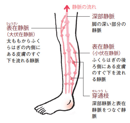 Những Dấu Hiệu Của Bệnh Giãn Tĩnh Mạch Là Gì? Tự Kiểm Tra Và Chẩn Đoán Qua Hình Ảnh. Những Dấu Hiệu Của Bệnh Giãn Tĩnh Mạch Là Gì? Tự Kiểm Tra Và Chẩn Đoán Qua Hình Ảnh.