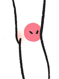 Những Dấu Hiệu Của Bệnh Giãn Tĩnh Mạch Là Gì? Tự Kiểm Tra Và Chẩn Đoán Qua Hình Ảnh. Những Dấu Hiệu Của Bệnh Giãn Tĩnh Mạch Là Gì? Tự Kiểm Tra Và Chẩn Đoán Qua Hình Ảnh.