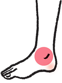 Những Dấu Hiệu Của Bệnh Giãn Tĩnh Mạch Là Gì? Tự Kiểm Tra Và Chẩn Đoán Qua Hình Ảnh. Những Dấu Hiệu Của Bệnh Giãn Tĩnh Mạch Là Gì? Tự Kiểm Tra Và Chẩn Đoán Qua Hình Ảnh.