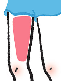 Những Dấu Hiệu Của Bệnh Giãn Tĩnh Mạch Là Gì? Tự Kiểm Tra Và Chẩn Đoán Qua Hình Ảnh. Những Dấu Hiệu Của Bệnh Giãn Tĩnh Mạch Là Gì? Tự Kiểm Tra Và Chẩn Đoán Qua Hình Ảnh.