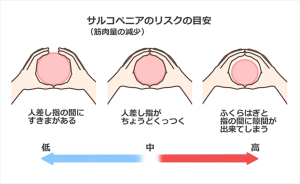 Sự Khác Biệt Giữa Yếu Đuối Và Thiểu Cơ Là Gì? Cách Phòng Ngừa Hiệu Quả Sự Khác Biệt Giữa Yếu Đuối Và Thiểu Cơ Là Gì? Cách Phòng Ngừa Hiệu Quả