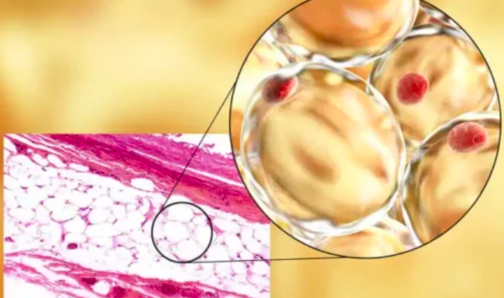 Tầm Quan Trọng Của Adiponectin Tầm Quan Trọng Của Adiponectin