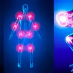 7 NGUYÊN NHÂNN GÂY ĐAU KHỚP