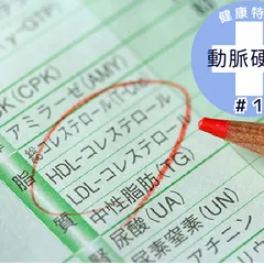 CHỈ SỐ CHOLESTEROL TIÊU CHUẨN THAY ĐỔI SAU TUỔI 55