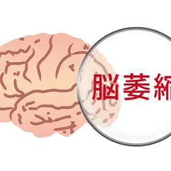 ĐỂ TRÁNH TÌNH TRẠNG BỘ NÃO CỦA ÔNG GIÀ! 4 ĐIỀU CẦN THỰC HIỆN