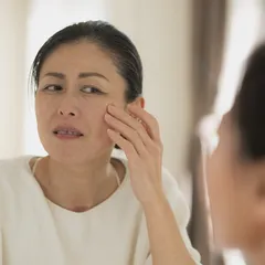 ĐỐM SẮC TỐ DO TUỔI TÁC LÀ GÌ? NGUYÊN NHÂN VÀ CÁCH KHẮC PHỤC