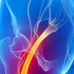 LÀM THẾ NÀO ĐỂ BIẾT BẠN CÓ BỊ ĐAU THẦN KINH TỌA HAY KHÔNG