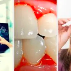 NGUY CƠ THIẾU HỤT VITAMIN