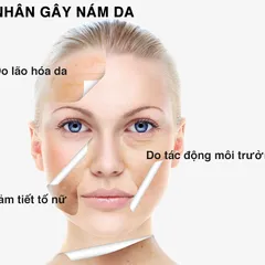 NGUYÊN NHÂN CHÍNH GÂY RA NÁM DA LÀ GÌ?