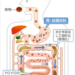 NGUYÊN NHÂN GÂY TÁO BÓN